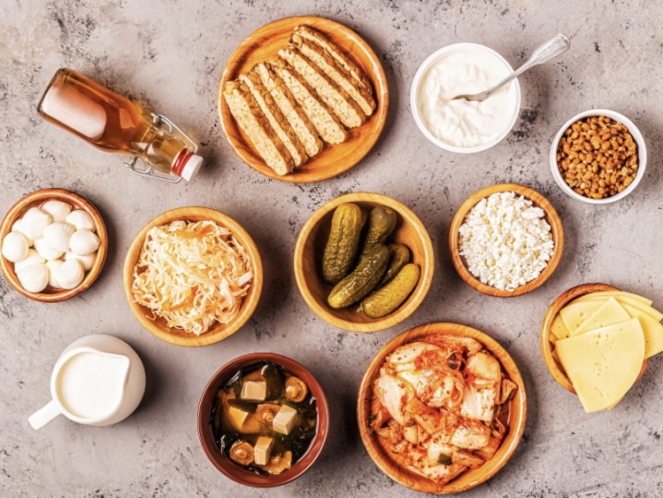 発酵食品のキムチ、ヨーグルト、納豆など